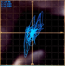 図19d 渦流信号 中キズの画像